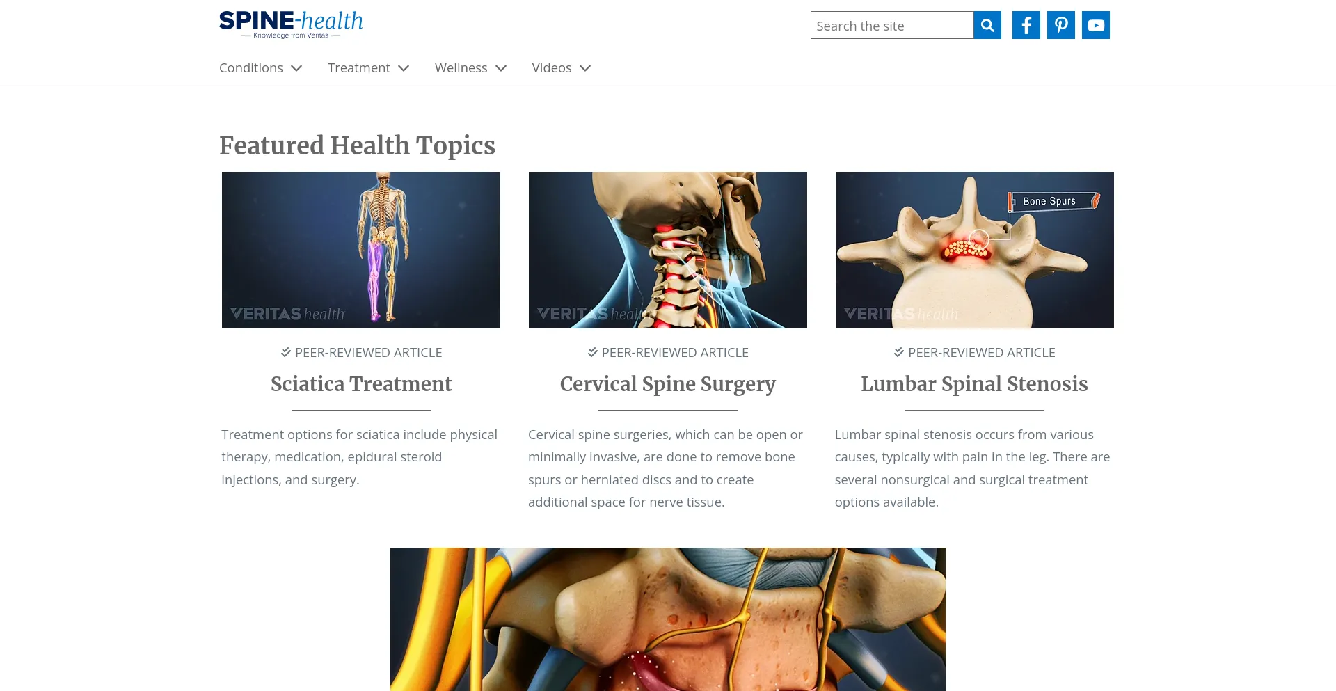 Screenshot of spine-health.com homepage